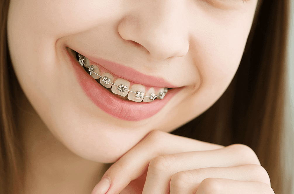 Сколько стоит снять брекеты?