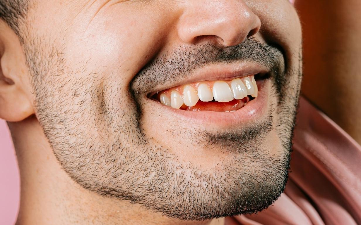 Можно ли отбеливать зубы?