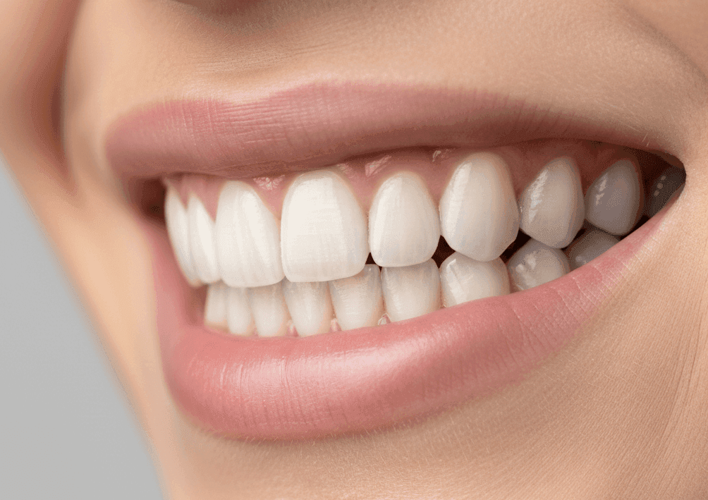 Щель между зубами