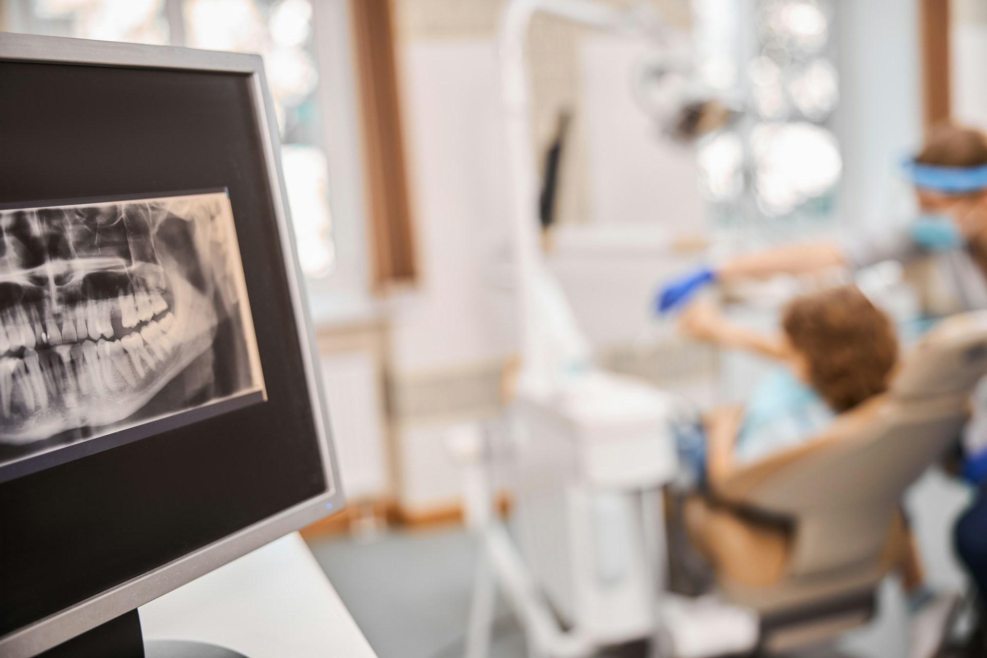 Как часто можно делать КТ зубов взрослому?