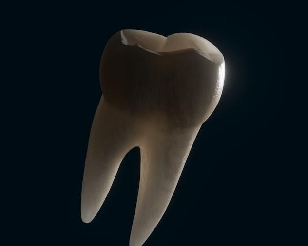 Нужно ли удалять зубы мудрости?