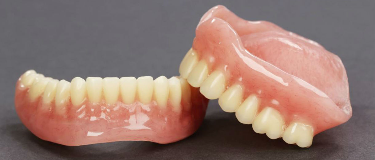 Протезирование зубов виды какой протез лучше фото