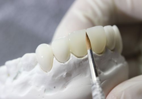 Циркониевый протез зубов