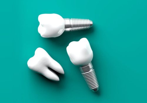 Какой имплант лучше ставить на жевательные зубы