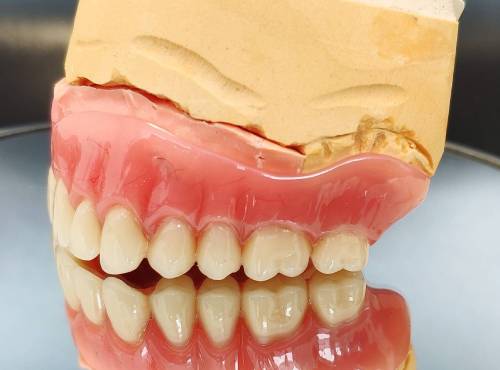 Накладные протезы для зубов