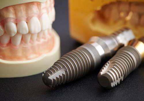 Немецкие импланты зубов