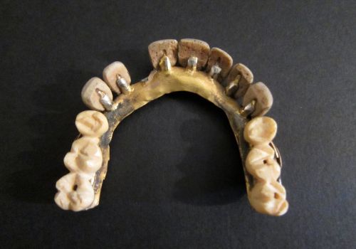 Первые зубные протезы