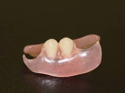 Съемные протезы на 2 зуба