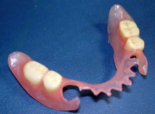Съемный протез на 4 жевательных зуба