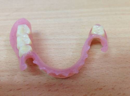 Съемный протез на четыре зуба